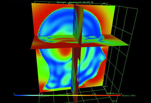 Visualisation using Flometrics MicroStripes.
